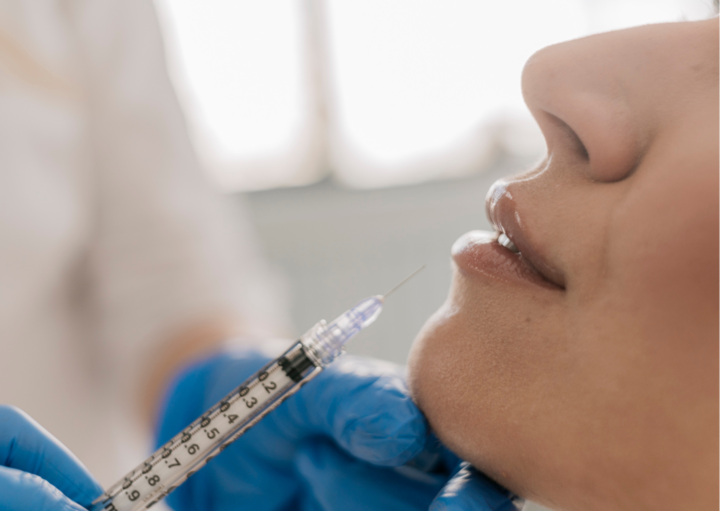 povećanje usana povećanje usnica